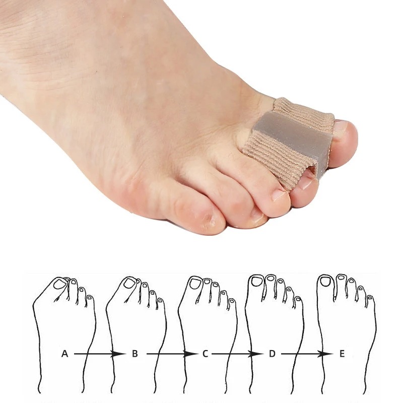 4 Séparateurs d'orteils en sil - Yoga Toe Separator avis et prix