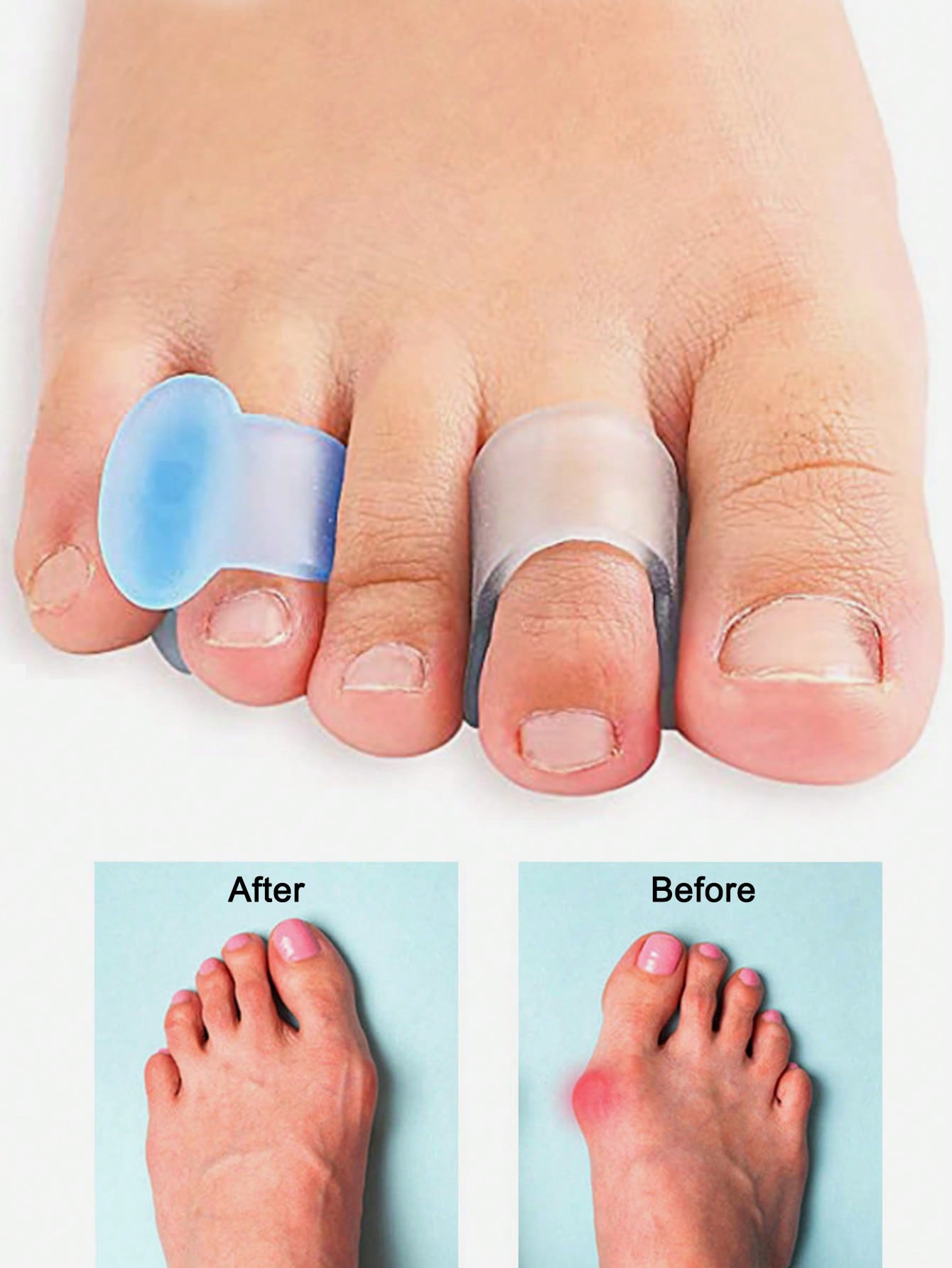 Séparateurs d'orteils en gel,  - Yoga Toe Separator avis et prix
